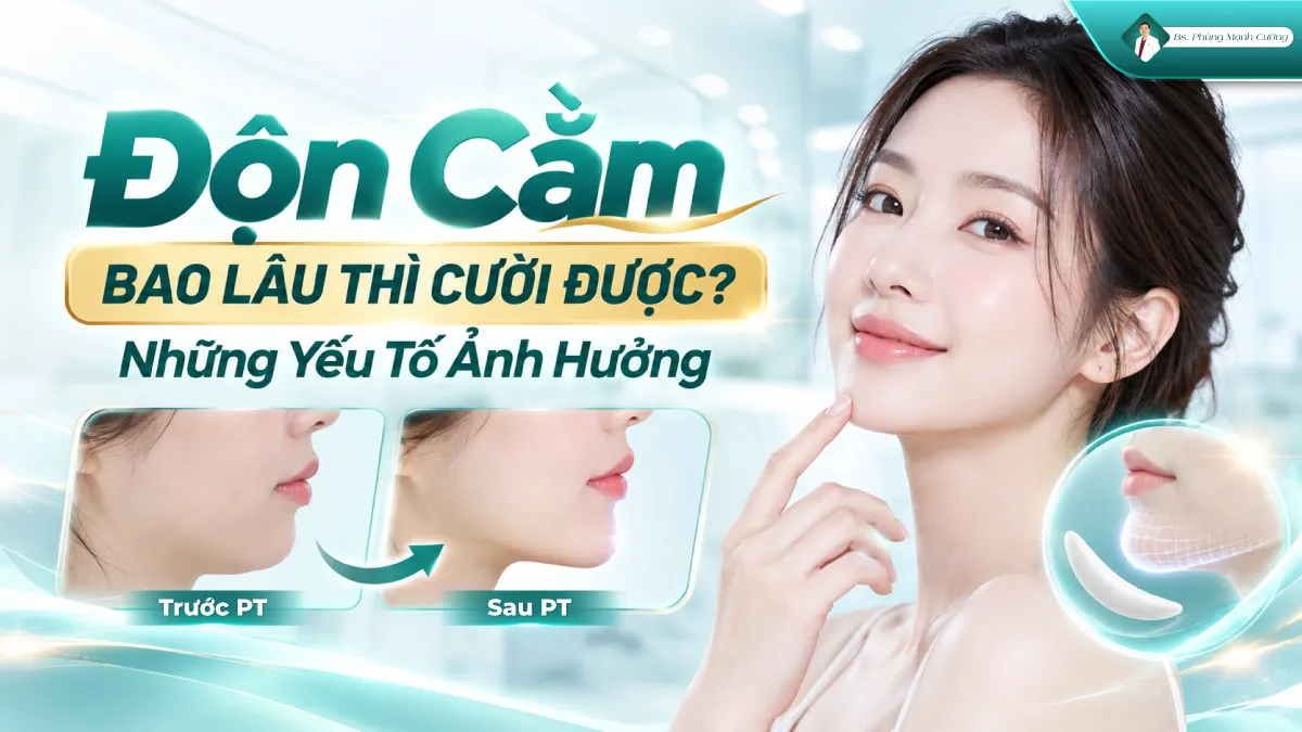 Độn Cằm Bao Lâu Thì Cười Được? Những Yếu Tố Ảnh Hưởng