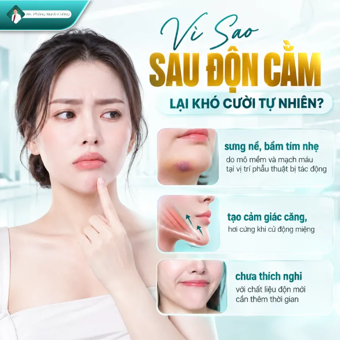 Độn Cằm Bao Lâu Thì Cười Được? Những Yếu Tố Ảnh Hưởng 7 Độn Cằm Bao Lâu Thì Cười Được? Những Yếu Tố Ảnh Hưởng