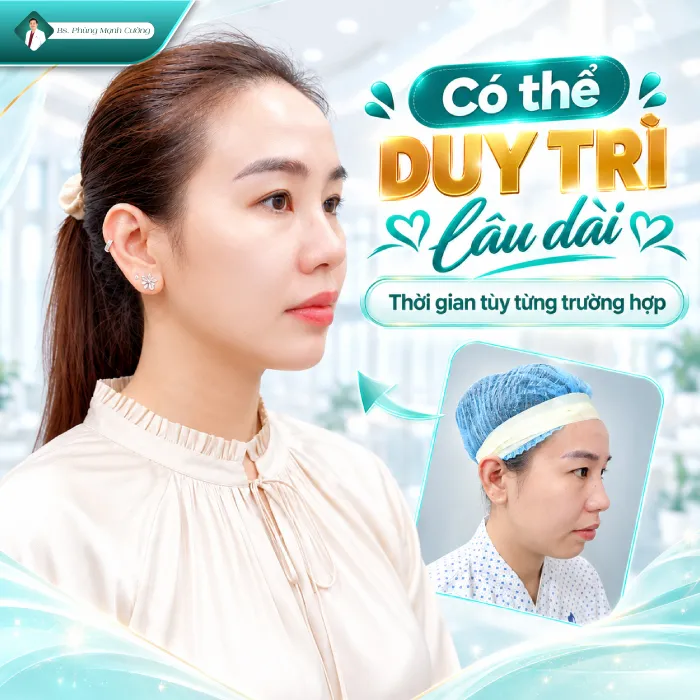 Độn Cằm Có Được Vĩnh Viễn Không? Bác Sĩ Phùng Mạnh Cường Giải Đáp 8 Độn Cằm Có Được Vĩnh Viễn Không? Bác Sĩ Phùng Mạnh Cường Giải Đáp