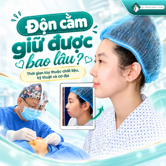 Độn Cằm Có Được Vĩnh Viễn Không? Bác Sĩ Phùng Mạnh Cường Giải Đáp 9 Độn Cằm Có Được Vĩnh Viễn Không? Bác Sĩ Phùng Mạnh Cường Giải Đáp