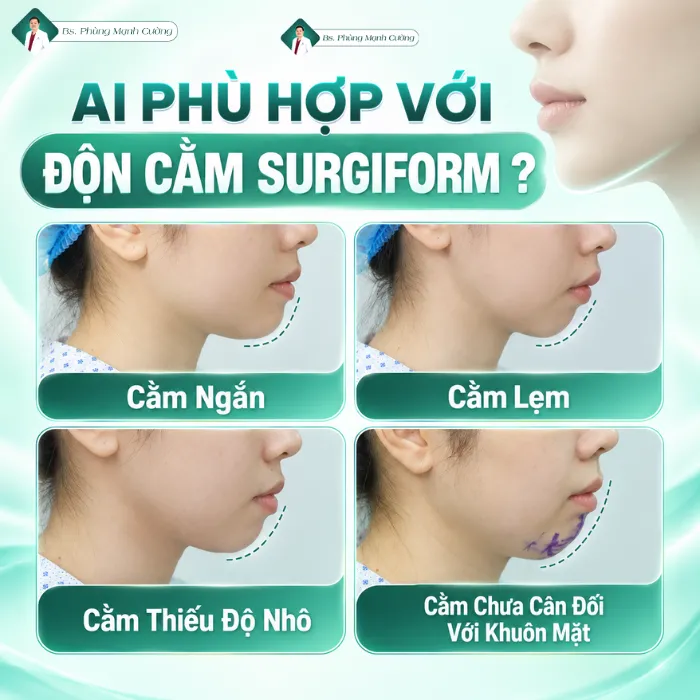 Độn Cằm Sụn Surgiform: Bác Sĩ Phùng Mạnh Cường Chia Sẻ Những Điều Cần Biết