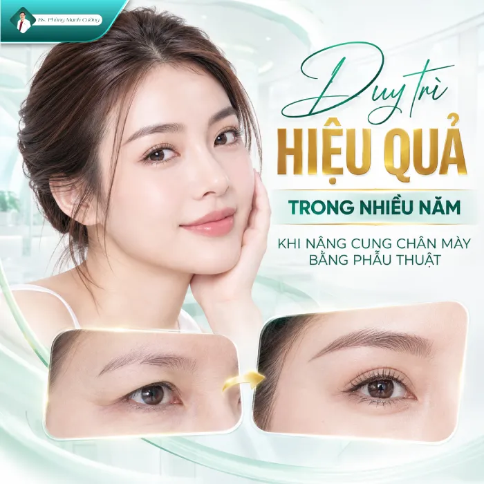 Nâng Cung Chân Mày Giữ Được Bao Lâu? Bác Sĩ Phùng Mạnh Cường Giải Đáp