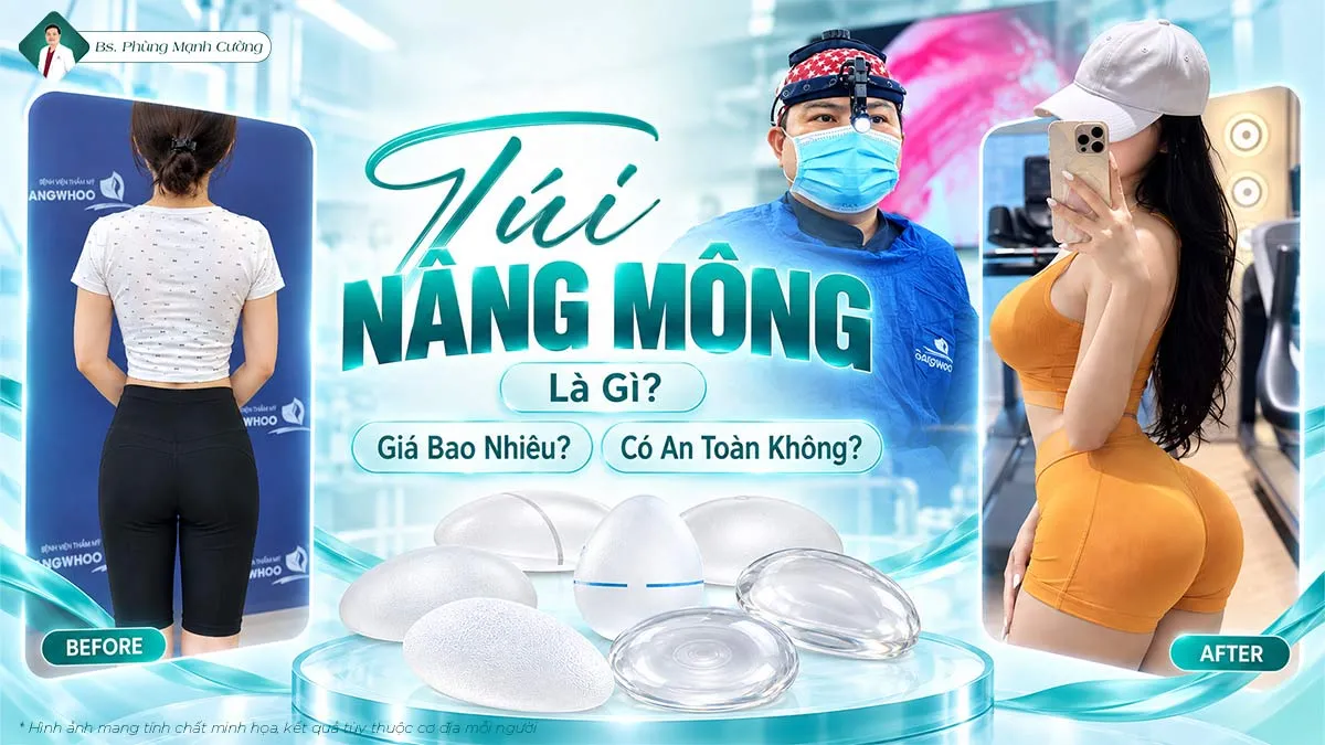 Túi Nâng Mông Là Gì? Giá Bao Nhiêu? Có An Toàn Không?