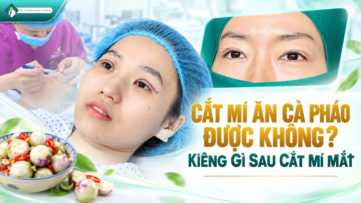Cắt Mí Ăn Cà Pháo Được Không? Kiêng Gì Sau Cắt Mí Mắt