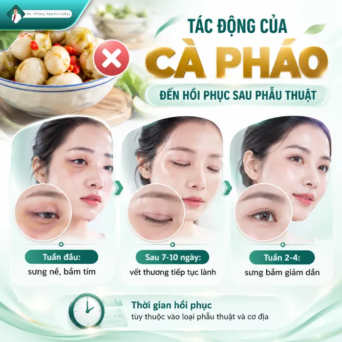 Cắt Mí Ăn Cà Pháo Được Không? Kiêng Gì Sau Cắt Mí Mắt
