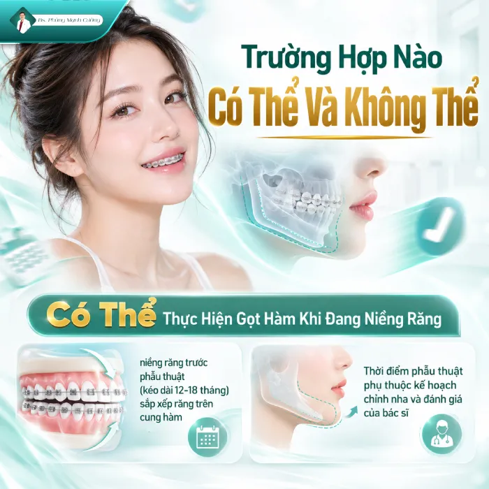 Đang Niềng Răng Có Gọt Hàm Được Không? Những Rui Ro Có Thể Xảy Ra