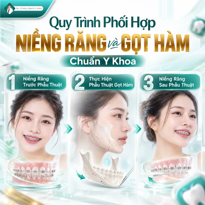 Đang Niềng Răng Có Gọt Hàm Được Không? Những Rui Ro Có Thể Xảy Ra