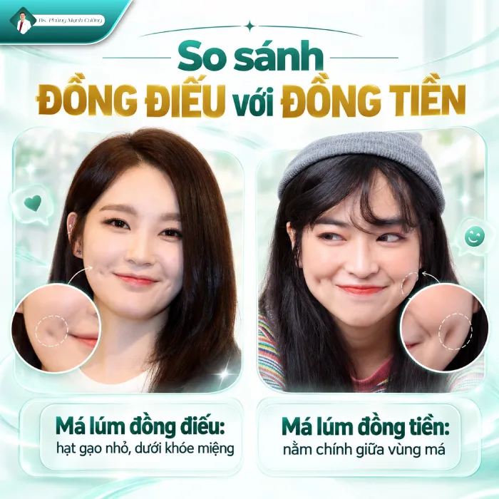 Má Lúm Đồng Điếu Là Gì? Bác Sĩ Phùng Mạnh Cường Giải Mã Từ A – Z