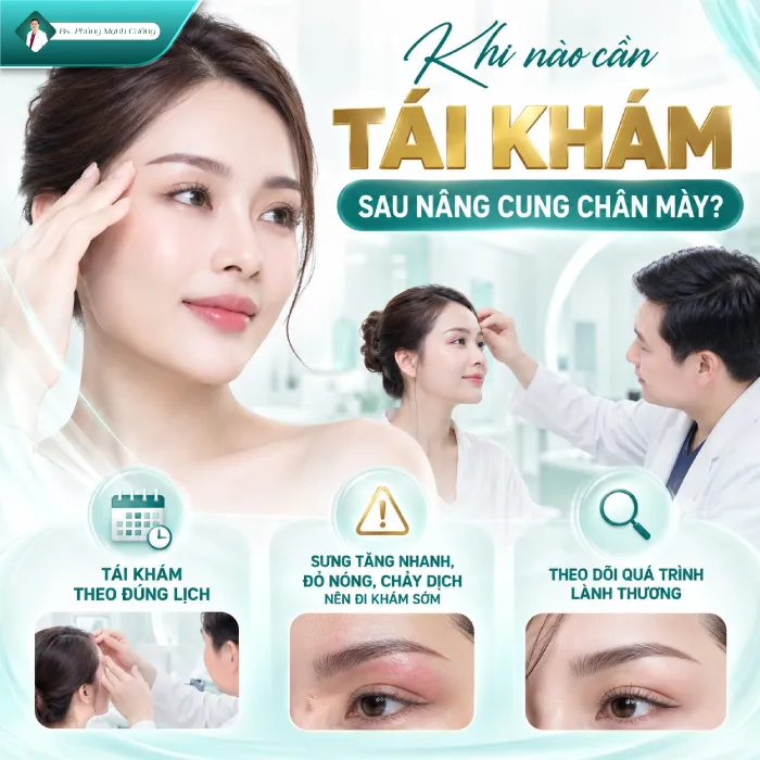 Nâng Cung Chân Mày Bao Lâu Thì Hết Sưng? Bác Sĩ Phùng Mạnh Cường Giải Đáp
