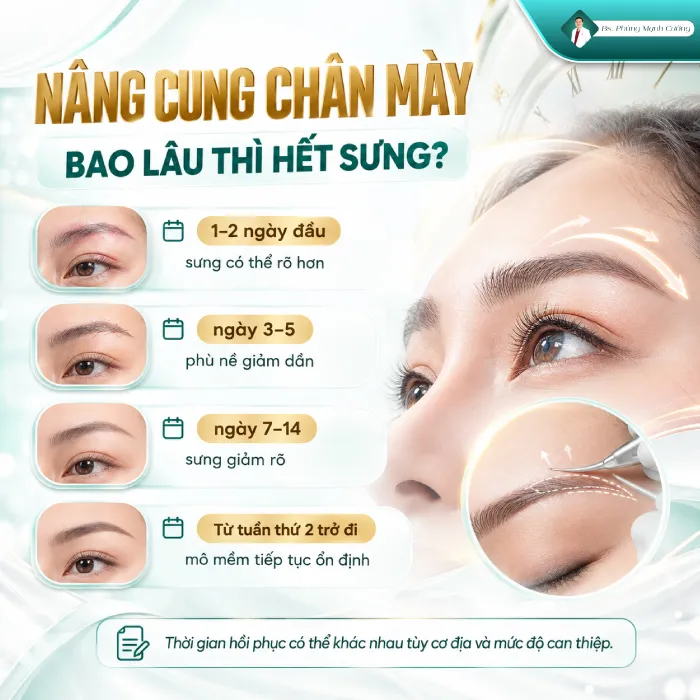 Nâng Cung Chân Mày Bao Lâu Thì Hết Sưng? Bác Sĩ Phùng Mạnh Cường Giải Đáp