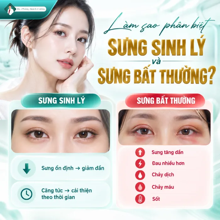 Nâng Cung Chân Mày Bao Lâu Thì Hết Sưng? Bác Sĩ Phùng Mạnh Cường Giải Đáp