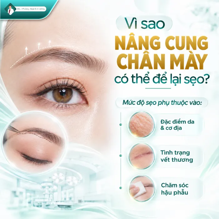 Nâng Cung Chân Mày Có Để Lại Sẹo Không? Giải Đáp Từ Góc Nhìn Chuyên Môn