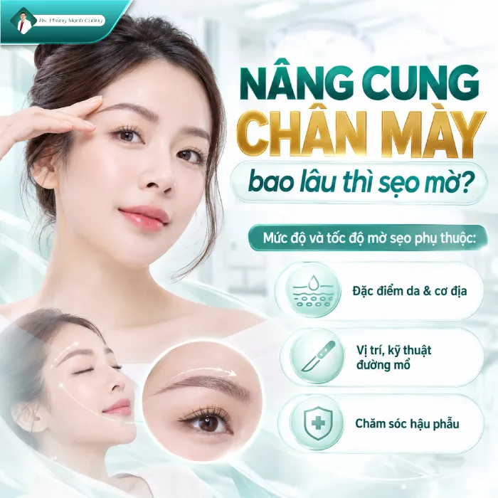 Nâng Cung Chân Mày Có Để Lại Sẹo Không? Giải Đáp Từ Góc Nhìn Chuyên Môn