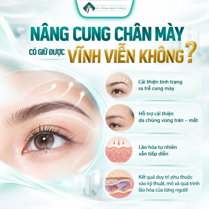 Nâng Cung Chân Mày Giữ Được Bao Lâu? Bác Sĩ Phùng Mạnh Cường Giải Đáp