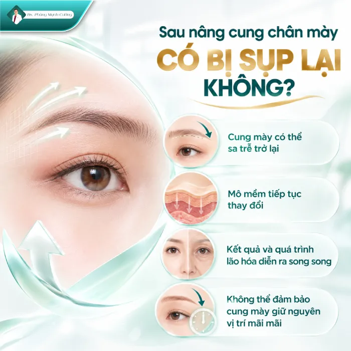 Nâng Cung Chân Mày Giữ Được Bao Lâu? Bác Sĩ Phùng Mạnh Cường Giải Đáp