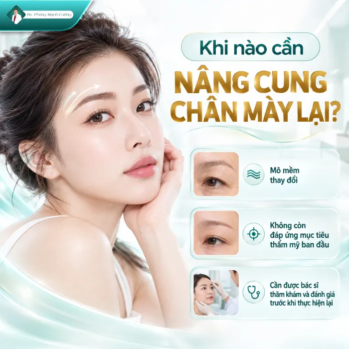 Nâng Cung Chân Mày Giữ Được Bao Lâu? Bác Sĩ Phùng Mạnh Cường Giải Đáp