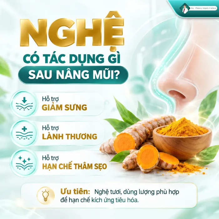 Nâng mũi ăn nghệ được không? Bác sĩ giải đáp 6 Nâng mũi ăn nghệ được không? Bác sĩ giải đáp