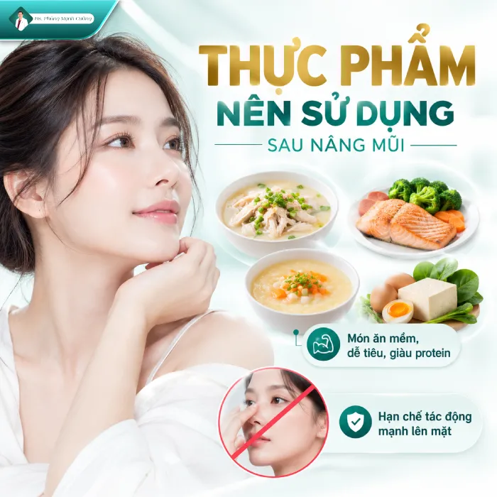 Nâng mũi ăn nghệ được không? Bác sĩ giải đáp 8 Nâng mũi ăn nghệ được không? Bác sĩ giải đáp
