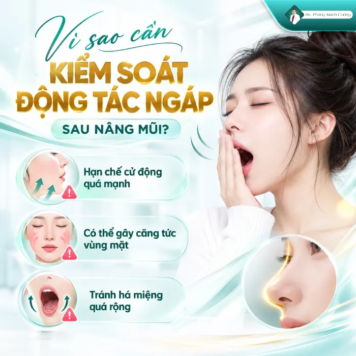 Nâng mũi có được ngáp không? Bác sĩ giải đáp