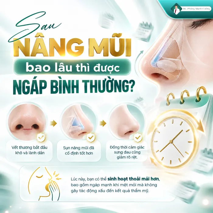 Nâng mũi có được ngáp không? Bác sĩ giải đáp