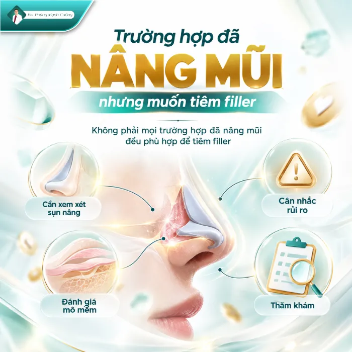Nâng mũi rồi có tiêm filler được không