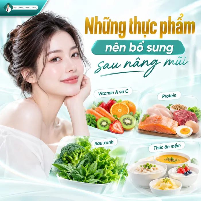 Nâng mũi uống rau má được không? Bác sĩ giải đáp 7 Nâng mũi uống rau má được không? Bác sĩ giải đáp