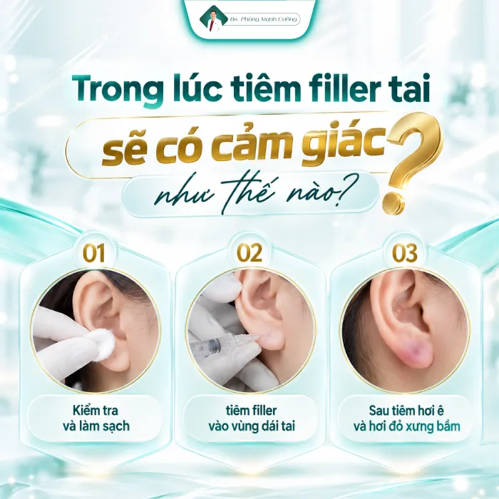 Tiêm Tai Tài Lộc Có Đau Không? Mức Độ Đau Và Cảm Giác Sau Tiêm 15 Tiêm Tai Tài Lộc Có Đau Không? Mức Độ Đau Và Cảm Giác Sau Tiêm