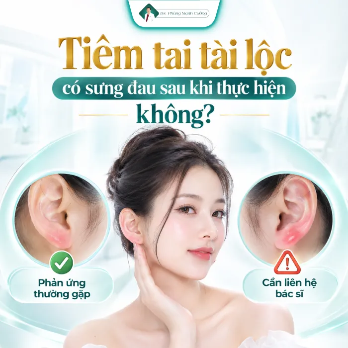 Tiêm Tai Tài Lộc Có Đau Không? Mức Độ Đau Và Cảm Giác Sau Tiêm 17 Tiêm Tai Tài Lộc Có Đau Không? Mức Độ Đau Và Cảm Giác Sau Tiêm
