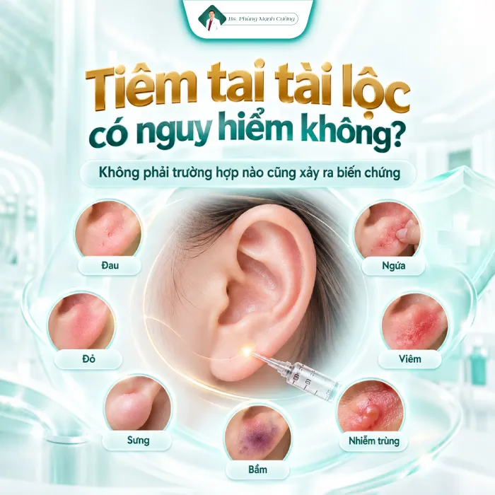 Tiêm Tai Tài Lộc Có Đau Không? Mức Độ Đau Và Cảm Giác Sau Tiêm 20 Tiêm Tai Tài Lộc Có Đau Không? Mức Độ Đau Và Cảm Giác Sau Tiêm