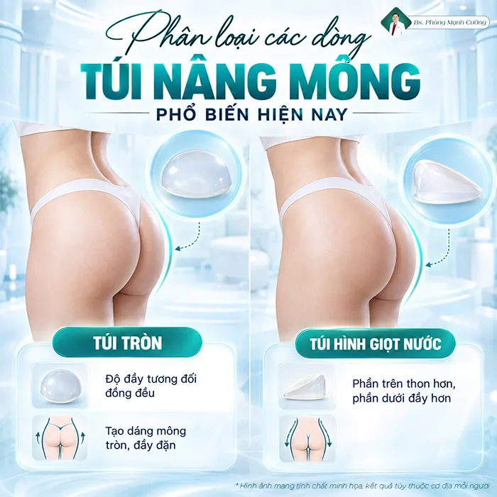 Túi Nâng Mông Là Gì? Giá Bao Nhiêu? Có An Toàn Không?