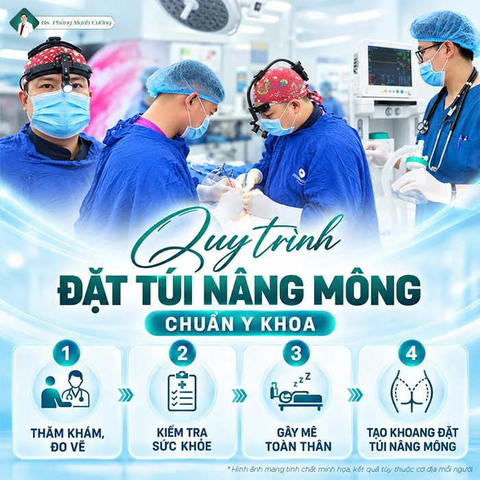 Túi Nâng Mông Là Gì? Giá Bao Nhiêu? Có An Toàn Không?