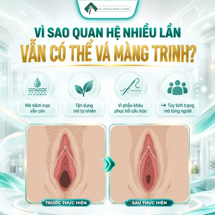 Vá Màng Trinh Được Không Khi Đã Quan Hệ Nhiều Lần? Bác Sĩ Phùng Mạnh Cường Giải Đáp