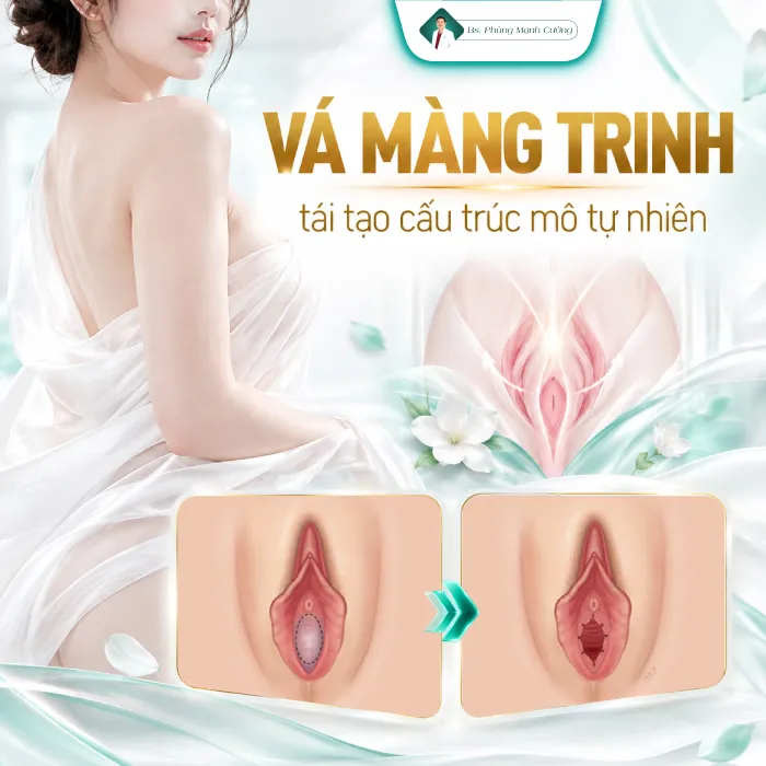 Vá Màng Trinh Là Gì? Có Nên Thực Hiện Vá Màng Trinh? 7 Vá Màng Trinh Là Gì? Có Nên Thực Hiện Vá Màng Trinh?
